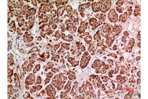 Immunohistochemistry (IHC) analysis of paraffin-embedded Human Pancreas, antibody was diluted at 1:100. (HPSE Antikörper  (Internal Region))