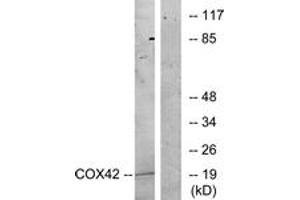 Western Blotting (WB) image for anti-Cytochrome C Oxidase Subunit IV Isoform 2 (Lung) (COX4I2) (AA 31-80) antibody (ABIN1534368)