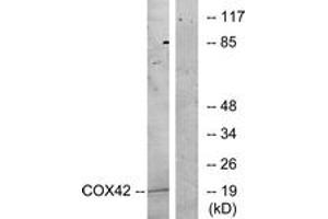 Western blot analysis of extracts from K562 cells, treated with insulin 0. (COX4I2 Antikörper  (AA 31-80))
