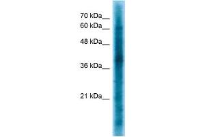 WB Suggested Anti-CRKL Antibody Titration: 1. (CrkL Antikörper  (Middle Region))