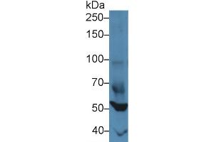 Western blot analysis of Mouse Heart lysate, using Mouse FOXP1 Antibody (3 µg/ml) and HRP-conjugated Goat Anti-Rabbit antibody ( (FOXP1 Antikörper  (AA 122-346))