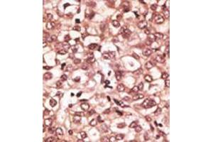 Image no. 2 for anti-Toll-Like Receptor 6 (TLR6) (C-Term) antibody (ABIN357053) (TLR6 Antikörper  (C-Term))