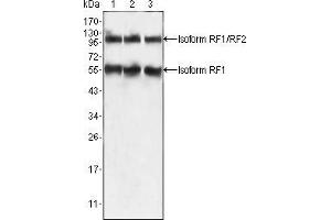Western blot analysis using PEG10 mouse mAb against HepG2 (1), SMMC-7721 (2) and A549 (3) cell lysate. (PEG10 Antikörper)