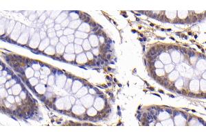 Immunohistochemistry (IHC) image for anti-BCL2-Like 1 (BCL2L1) (AA 2-212) antibody (ABIN7437176)