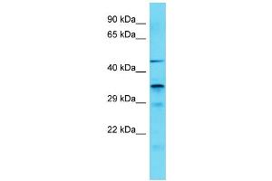 Host: Rabbit Target Name: IST1 Sample Type: COLO205 Whole Cell lysates Antibody Dilution: 1. (IST1 Antikörper  (C-Term))