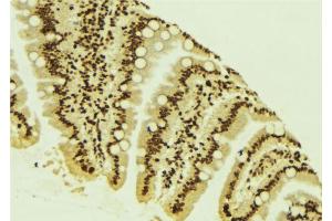 ABIN6266588 at 1/100 staining Mouse colon tissue by IHC-P. (MDM2 Antikörper)