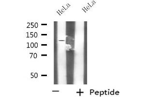 Western blot analysis of extracts from HeLa cells, using KCNH3 antibody. (KCNH3 Antikörper  (C-Term))