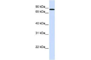 MAP4K2 antibody used at 1 ug/ml to detect target protein. (MAP4K2 Antikörper  (N-Term))