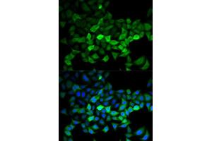 Immunofluorescence analysis of HeLa cells using UBE2C antibody (ABIN5973207). (UBE2C Antikörper)