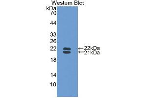 Western blot analysis of the recombinant protein. (Haptoglobin Antikörper  (AA 118-281))