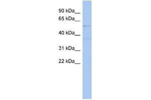 WB Suggested Anti-SMYD2 Antibody Titration:  0. (SMYD2A Antikörper  (Middle Region))