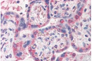 Human Placenta (formalin-fixed, paraffin-embedded) stained with PDLIM1 antibody ABIN337145 at 5 ug/ml followed by biotinylated anti-goat IgG secondary antibody ABIN481715, alkaline phosphatase-streptavidin and chromogen. (PDLIM1 Antikörper  (AA 316-329))