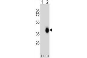 Western blot analysis of FCAR (arrow) using rabbit polyclonal FCAR Antibody (Center) . (FCAR Antikörper  (Middle Region))