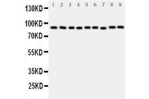 Western Blotting (WB) image for anti-Valosin Containing Protein (VCP) (AA 749-766), (C-Term) antibody (ABIN3043984) (VCP Antikörper  (C-Term))