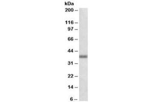 Western blot testing of human lung lysate with OXER1 antibody at 1ug/ml. (OXER1 Antikörper)
