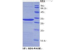 SDS-PAGE (SDS) image for Galectin 3 (LGALS3) (AA 1-250) protein (His tag) (ABIN1079621)
