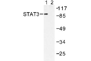 Image no. 1 for anti-Signal Transducer and Activator of Transcription 3 (Acute-Phase Response Factor) (STAT3) antibody (ABIN271827) (STAT3 Antikörper)