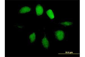 Immunofluorescence of purified MaxPab antibody to UBL4A on HeLa cell. (UBL4A Antikörper  (AA 1-157))