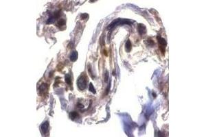 Immunohistochemical staining of ARTS in human lung tissue with ARTS antibody at 2μg/ml. (Septin 4 Antikörper  (N-Term))