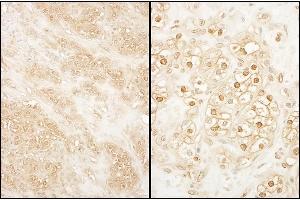 anti-Cyclin-Dependent Kinase 17 (CDK17) (AA 1-50) antibody