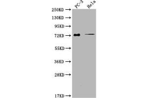 Western Blot Positive WB detected in: PC-3 whole cell lysate, Hela whole cell lysate All lanes: GLB1L3 antibody at 1:2000 Secondary Goat polyclonal to rabbit IgG at 1/50000 dilution Predicted band size: 75, 36 kDa Observed band size: 75 kDa (GLB1L3 Antikörper  (AA 1-236))