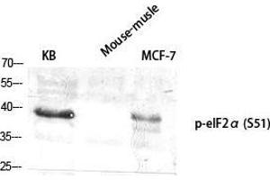 Western Blot (WB) analysis of specific cells using Phospho-eIF2alpha (S51) Polyclonal Antibody. (EIF2A Antikörper  (pSer51))
