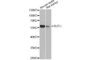 Western blot analysis of extracts of various cell lines, using SUFU antibody (ABIN6293839) at 1:1000 dilution. (SUFUH Antikörper)