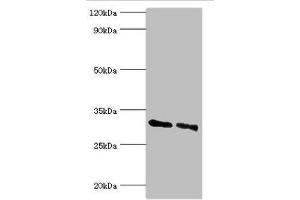 Western blot All lanes: KCTD15 antibody at 8 μg/mL Lane 1: 293T whole cell lysate Lane 2: Hela whole cell lysate Secondary Goat polyclonal to rabbit IgG at 1/10000 dilution Predicted band size: 32, 27 kDa Observed band size: 32 kDa (KCTD15 Antikörper  (AA 1-234))