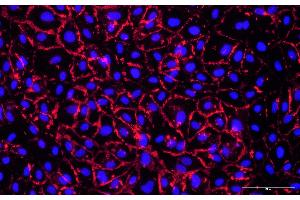 HUVEC cells were stained using a primary rabbit anti-human CD31 antibody, followed by detection with animal-free AlexaFluor555-conjugated anti-rabbit IgG secondary Multiclonal antibody (ABIN7581785). (Rekombinanter Maus anti-Kaninchen IgG Antikörper (Alexa Fluor 555))