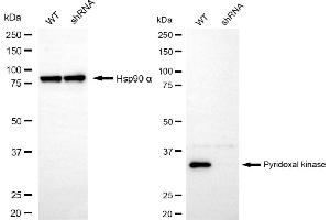 Western blotting analysis using pyridoxal kinase antibody (ABIN7800072). (PDXK Antikörper)