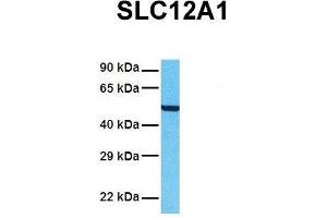 Host:  Rabbit  Target Name:  SLC12A1  Sample Tissue:  Human A549  Antibody Dilution:  1.