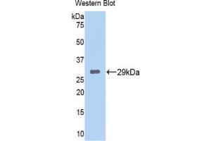Western blot analysis of the recombinant protein. (TPSB2 Antikörper  (AA 35-275))