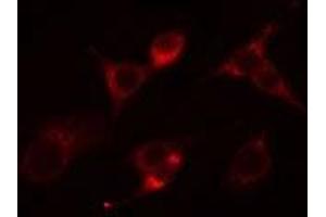 ABIN6266546 staining Hela cells by IF/ICC. (Glucagon Antikörper)