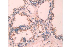 Used in DAB staining on fromalin fixed paraffin- embedded Kidney tissue (TCN2 Antikörper  (AA 19-427))