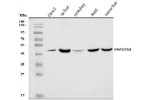 Western blot analysis of HMGCS2 using anti-HMGCS2 antibody (ABIN7599435).