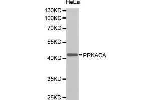 Western blot analysis of extracts of HeLa cells, using PRKACA antibody (ABIN5995919). (PRKACA Antikörper)