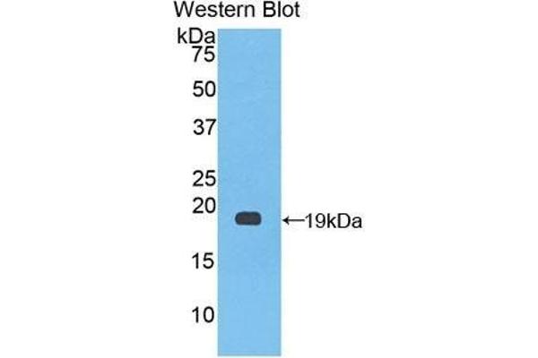 Factor VIII antibody  (AA 1887-2044)