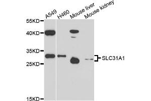 Western blot analysis of extracts of various cell lines, using SLC31A1 antibody (ABIN6003807) at 1/1000 dilution. (SLC31A1 Antikörper)