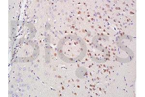 Formalin-fixed and paraffin embedded mouse brain labeled with Anti-A2AR/Adenosine A2a Polyclonal Antibody, Unconjugated (ABIN686797) at 1:200 followed by conjugation to the secondary antibody and DAB staining