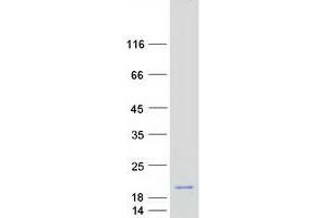 Validation with Western Blot (C1D Protein (Transcript Variant 1) (Myc-DYKDDDDK Tag))