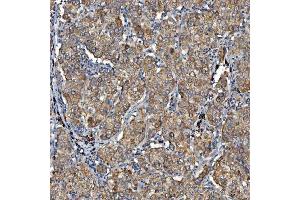 IHC analysis of SDF2L1 using anti-SDF2L1 antibody (ABIN7601111). (SDF2L1 Antikörper  (AA 29-221))