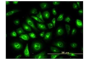 Immunofluorescence (IF) image for anti-Keratin 81 (KRT81) (AA 1-203) antibody (ABIN614629)