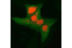 IF analysis of RNF34 and Tubulin beta using anti-RNF34 antibody (ABIN7602457) and anti-Tubulin beta antibody (ABIN7602744). (RNF34 Antikörper  (AA 46-372))