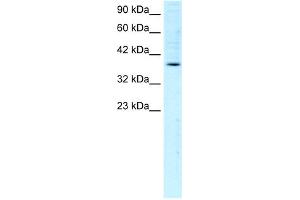 WB Suggested Anti-FOSB Antibody Titration:  1. (FOSB Antikörper  (C-Term))