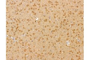 ABIN6260322 and ABIN6279883 at 1/100 staining rat brain tissue by IHC-P. (BTF3L4 Antikörper  (Internal Region))