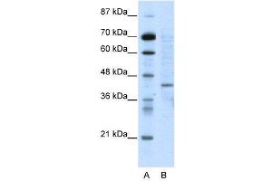 WB Suggested Anti-RING1  Antibody Titration: 5. (RING1 Antikörper  (N-Term))