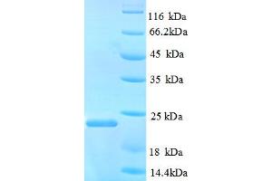 SDS-PAGE (SDS) image for Nitric Oxide Synthase 3 (Endothelial Cell) (NOS3) (AA 519-690) protein (His tag) (ABIN5713030) (ENOS Protein (AA 519-690) (His tag))