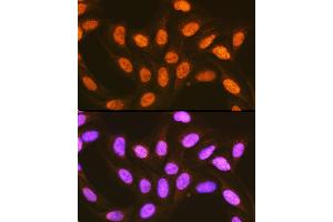 Immunofluorescence analysis of U-2 OS cells using hnRNP E2/PCBP2 Rabbit pAb (ABIN3023339, ABIN3023340, ABIN3023341 and ABIN6219620) at dilution of 1:100 (40x lens).