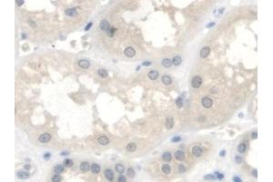 Immunohistochemistry (IHC) image for anti-Insulin-Like Growth Factor Binding Protein 2, 36kDa (IGFBP2) (AA 148-325) antibody (ABIN7430594)