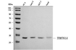 Western blot analysis of TRMT61A using anti-TRMT61A antibody (ABIN7599220).